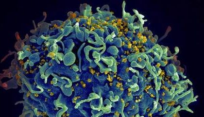 Paciente na Suíça é a sexta pessoa no mundo curada do HIV
