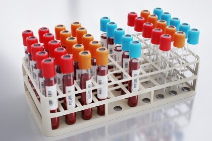O que os exames de sangue mostram sobre as funções do organismo?