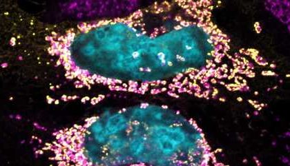 Estudo revela proteína bacteriana capaz de manter a célula humana saudável por mais tempo