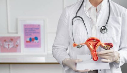 Papanicolau Utero Hpv 09082023130204246
