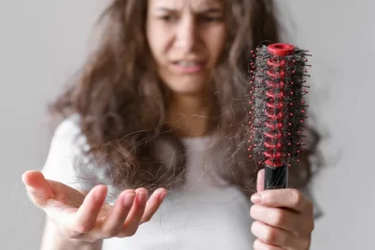 Femea Com Cabelo Emaranhado